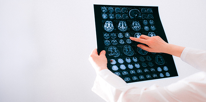 Neurología en Écija